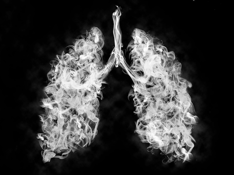 Aspergillosis’ effect on the lungs