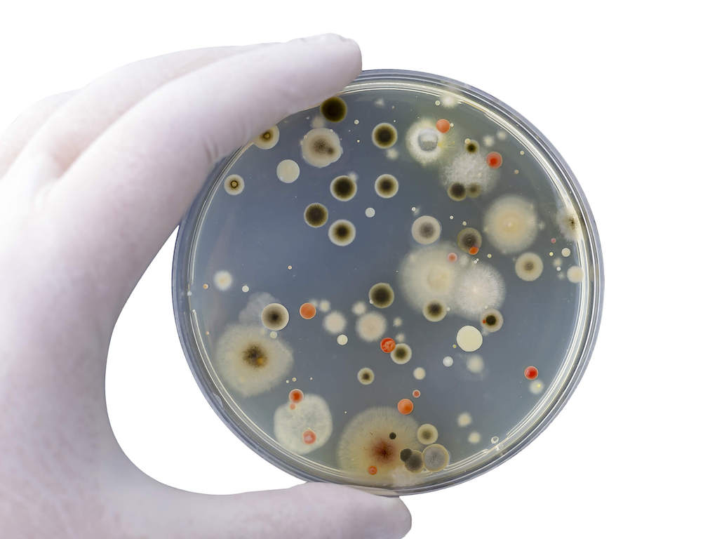 Does Mold Kill Bacteria at Steven Alvarado blog